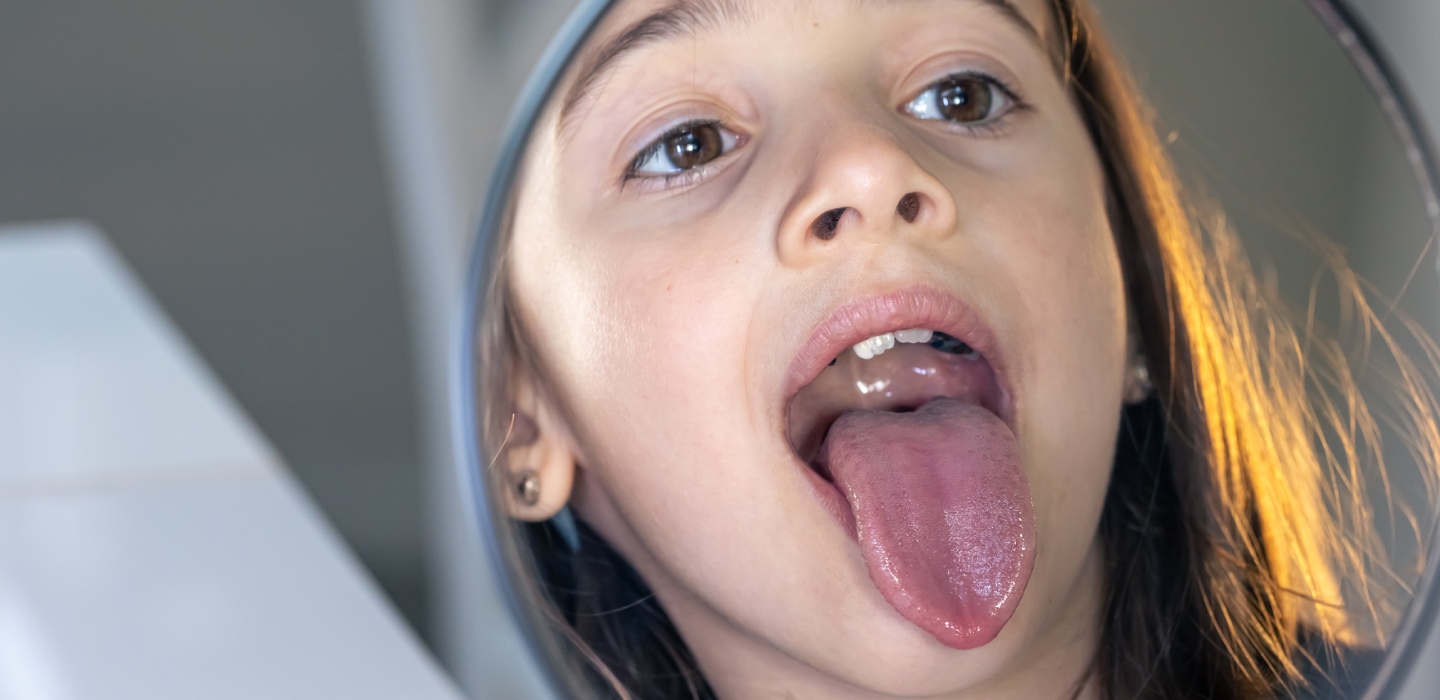 glp 1 tongue side effects What is Ozempic tongue? | Beauty Sculpting Room